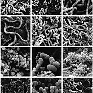 scanning electron micrograph of Trichococcus flocculiformis