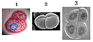Key Characteristics of Deinococcus radiodurans