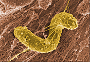 Environmentally Significant Bacterium: Desulfovibrio desulfuricans