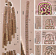 Here's the Microscopic image of the organism in question!