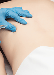 Trigger Point Injection | Musculoskeletal Conditions | RAD Clinic