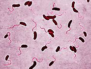 vibrio cholerae under the microscope