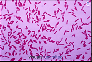 A Gram stain image of Pseudomonas putida showing its rod shape and motility