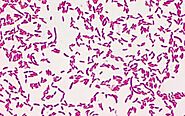 Pseudomonas Fluorescens Gram reaction