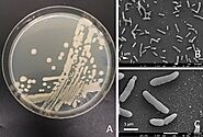 Pseudomonas Fluorescens-microwiki (Ecologically)
