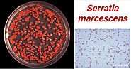 Application and Benefits of S.marcescens