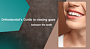 Orthodontist’s Guide to closing gaps between the teeth - Repur Tech