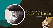 Understanding the Cost of Veneers in London: Your Guide