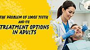 The problem of loose teeth and its treatment options in adults - Bipko Biz