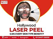 Hollywood Laser Peel: Can Every Skin Type Benefit? - Dermatologist in Delhi | Skin Specialist in Delhi