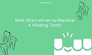 Best Alternatives to Replace A Missing Tooth