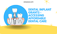 Dental Implant Grants: Accessing Affordable Dental Care - 2025