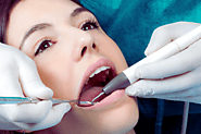 🦷 Best Teeth Care Centre in Ahmedabad – Where Smiles Shine Bright