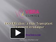 How Effective is Hair Transplant Treatment in Udaipur