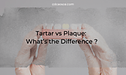Tartar vs Plaque: What's the Difference ? 2025