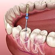 Dentistry in Markham, ON, Canada