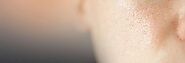 Transform Your Skin with Advanced Open Pores Treatment