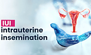 IUI Treatment in Delhi | Best IUI Centre by Dr. Poonam Goyal