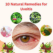 10 Natural Remedies for Uveitis - Herbal Care Products - Blog