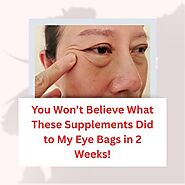 You Won’t Believe What These Supplements Did to My Eye Bags in 2 Weeks