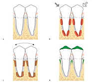 Các yếu tố ảnh hưởng tới giá làm răng implant