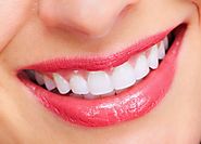 Tiến hành làm răng implant cần lưu ý những gì