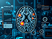 AI Tool Revolutionizes Multiple Sclerosis Diagnosis