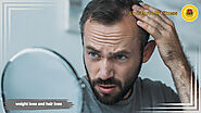 Can Weight Loss Cause Hair Loss? - Live Force In Fitness
