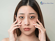 Restore Youthful Eyes with Safe and Effective Treatments