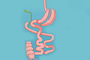 Bipartition Surgery | Best Bariatric Surgeon in Hyderabad