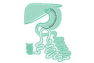 Sleeve DJB Surgery | Best Bariatric Surgeon in Hyderabad