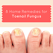 How to Get Rid of Toenail Fungus? Home Remedies for Toenail Fungus
