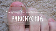 Paronychia: Learn Symptoms, Causes, Home Remedies and Treatments