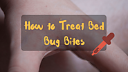 10 Simple Ways To Get Rid Of Bed Bug Bites - Home Remedies