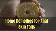 Top 6 Remedies For Anal Skin Tags Removal - Home Remedies Living
