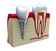 Sarasota Smile Design