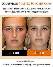 Louisville Plastic Surgeon