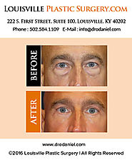 Louisville Plastic Surgeon