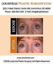 Louisville Plastic Surgeon