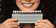 Dental Veneers Treatment : Step by Step Process