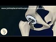 Low Cost Hip Replacement Surgery In India | Jointreplacementsurgeryhospitalindia.com