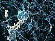 Resveratrol study offers new insight into Alzheimer's
