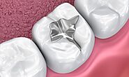 This Dentist Gets DMs! Dr. Kevin Molldrem Now Answers Dental Questions via Instagram Stories