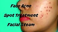 Acne On My Face | Spot Treatment | Facial Steam