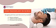 Frequently Asked Questions About Female Hair Transplant