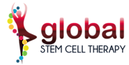 Osteoarthritis Stem Cell Treatment in India | Global Stem Cell Therapy