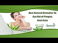 Best Natural Remedies To Get Rid of Pimples And Acne
