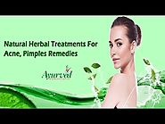 Natural Herbal Treatments For Acne, Pimples Remedies