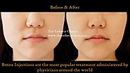 Botox Injection Treatment for Masseter Hypertrophy - The Esthetic Clinics