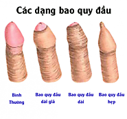 Làm sao biết mình bị hẹp bao quy đầu?